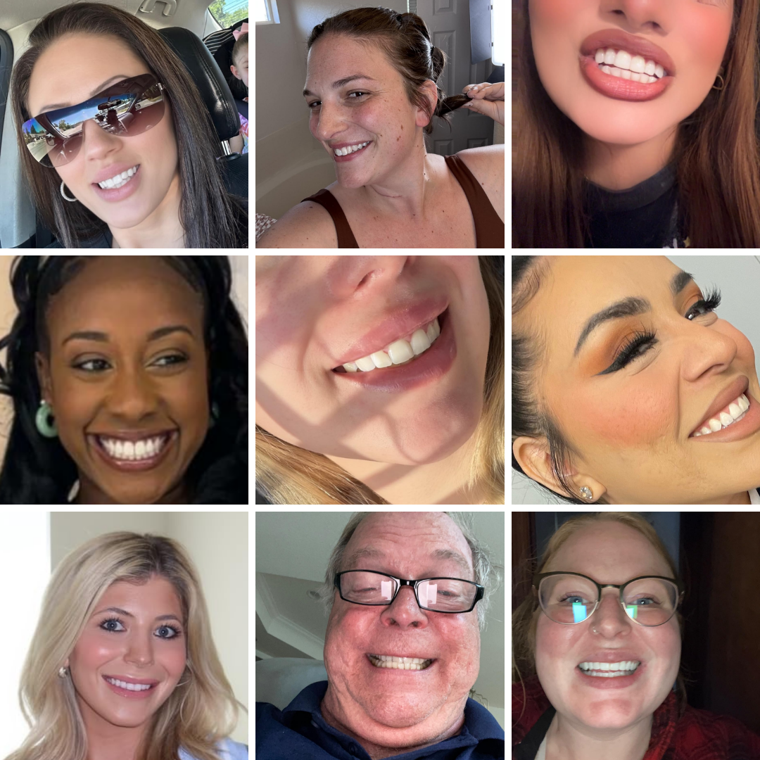 Teeth Whitening Strips (21 Strips)