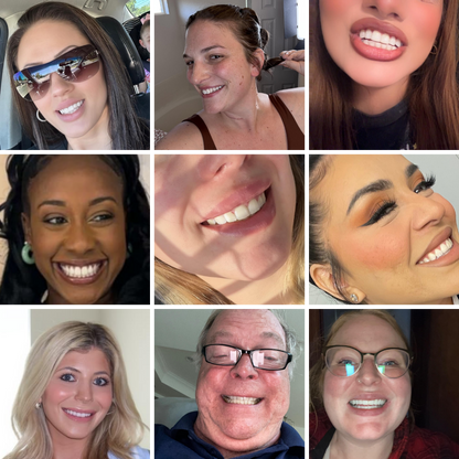 Teeth Whitening Strips (21 Strips)