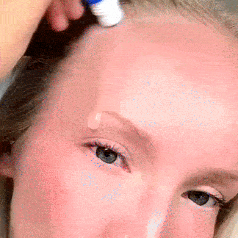 Viral Rosemary Hair Growth Roller For Fuller Hair