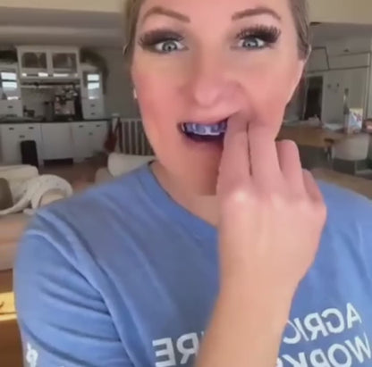 Teeth Whitening Strips (21 Strips)